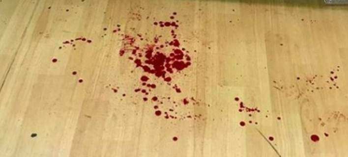 Επίθεση στον προπονητή του Παναιγινιακού με σιδερογροθιά - Κατά τη διάρκεια του αγώνα.