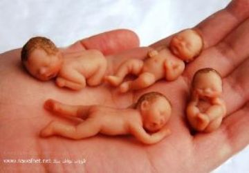 Η Ελλάδα πρώτη χώρα σε εκτρώσεις στην Ευρώπη.