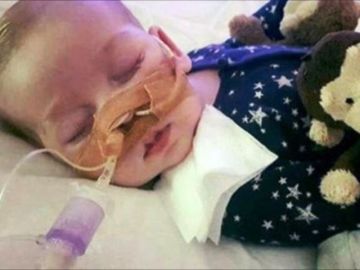 Πέθανε ο μικρούλης Τσάρλι Γκαρντ -Το αγοράκι που βρέθηκε εν μέσω δικαστικής διαμάχης. 