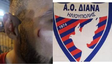 Μαχαίρωσαν στο πρόσωπο τον τερματοφύλακα της ΔΙΑΝΑΣ  Άντι Μπέτσκο.