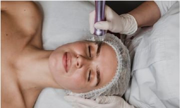 Fractional Laser: Στοχευμένη Ανάπλαση Δέρματος