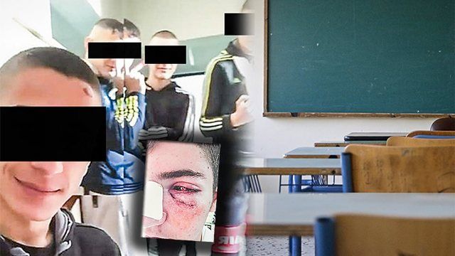 Bullying στα σχολεία: Οι Locos του Βύρωνα και η φωτογραφία σοκ του 17χρονου θύματος