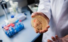 Candida auris: Ο μύκητας των νοσοκομείων εντοπίστηκε στην Αττική - Τρομακτικές προβλέψεις Σύψα
