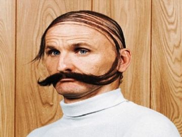 ΑΛΜΑΤΩΔΗΣ Η ΕΞΕΛΙΞΗ ΣΤΗ ΜΕΤΑΜΟΣΧΕΥΣΗ ΜΑΛΛΙΩΝ. ΚΑΙ ΟΙ ...ΣΠΑΝΟΙ ΑΠΟΚΤΟΥΝ ΓΕΝΙΑ